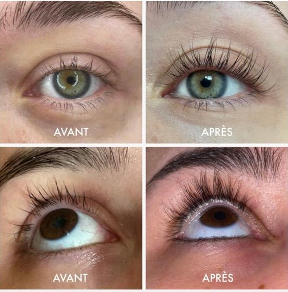 Sérum pour les cils : est-ce dangereux ?