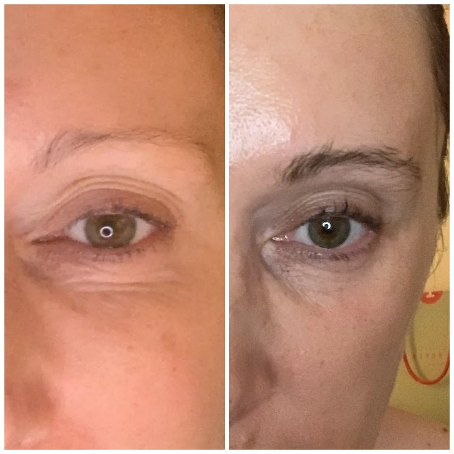 Eyelash serum + eyebrow serum pack.