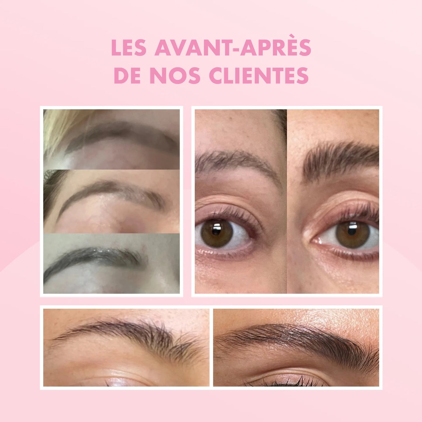 G'BROW - Eyebrow Growth Serum